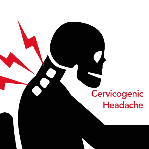 CERVICOGENIC HEADACHES