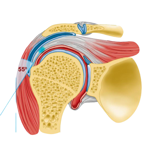 SUPRASPINATUS TENDINITIS